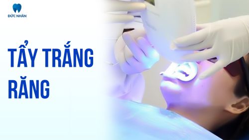 Tẩy Trắng Răng